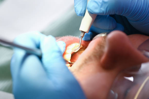 Best Emergency Root Canal Therapy in Franconia, VA