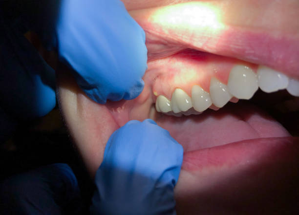 Best Emergency Cosmetic Dentistry (e.g., broken veneers) in Franconia, VA